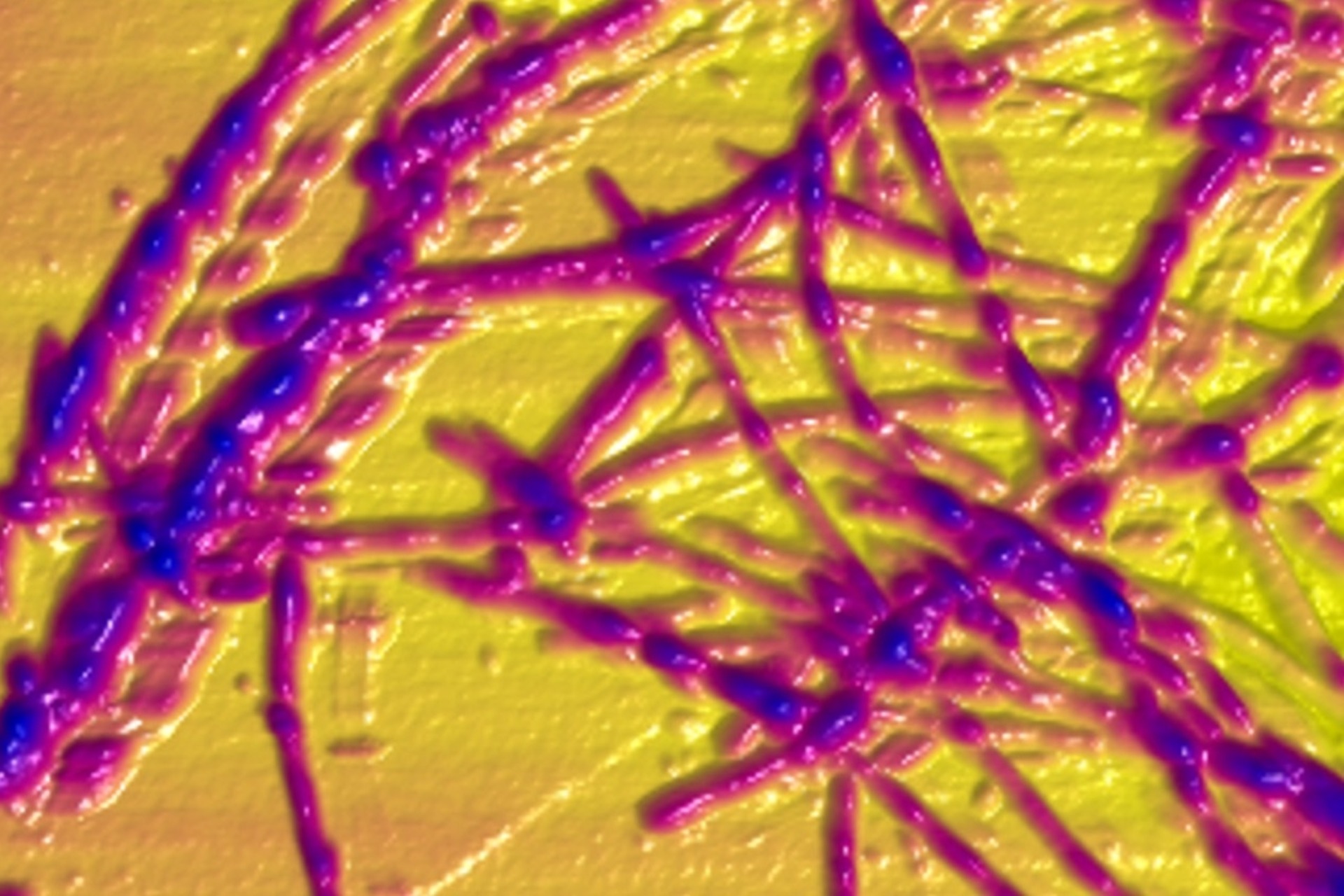 Fibrille di alfa-sinucleina dopo il contatto con ioni di rame