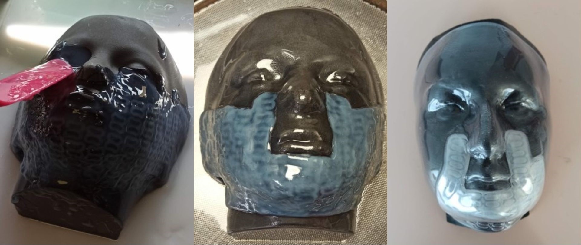 Le innovative maschere facciali 3D per le ustioni dei bambini