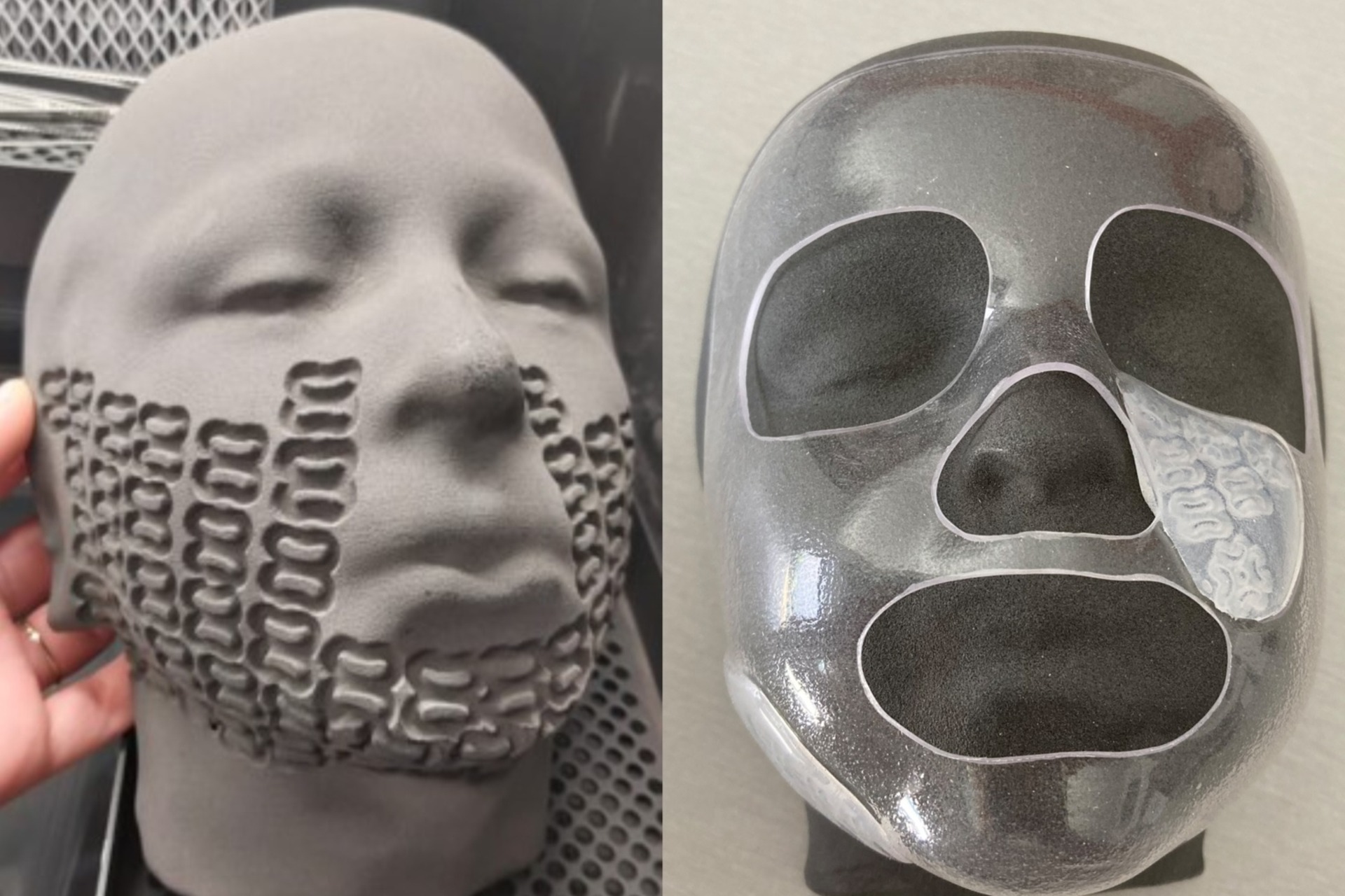 Le innovative maschere facciali 3D per le ustioni dei bambini