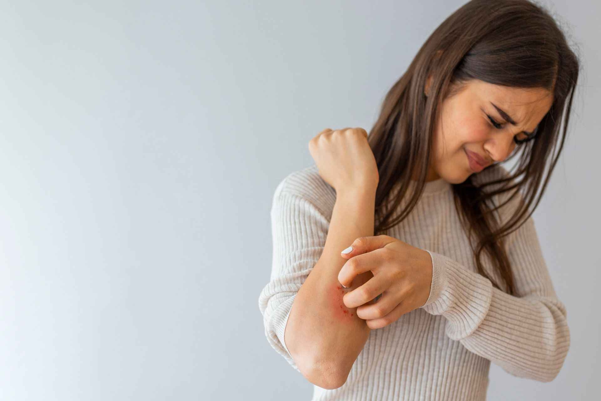 Dermatite: dermatite, rimedi e prevenzione sono in stretta connessione con il cibo e le abitudini alimentari