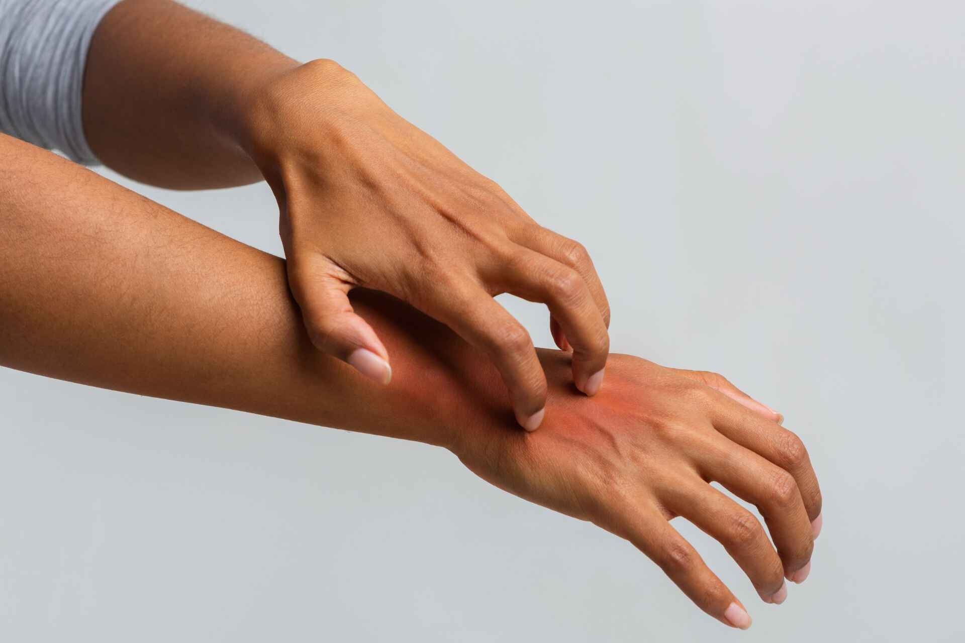Psoriasi: cause, sintomi, cure e trattamenti in un’ottica innovativa