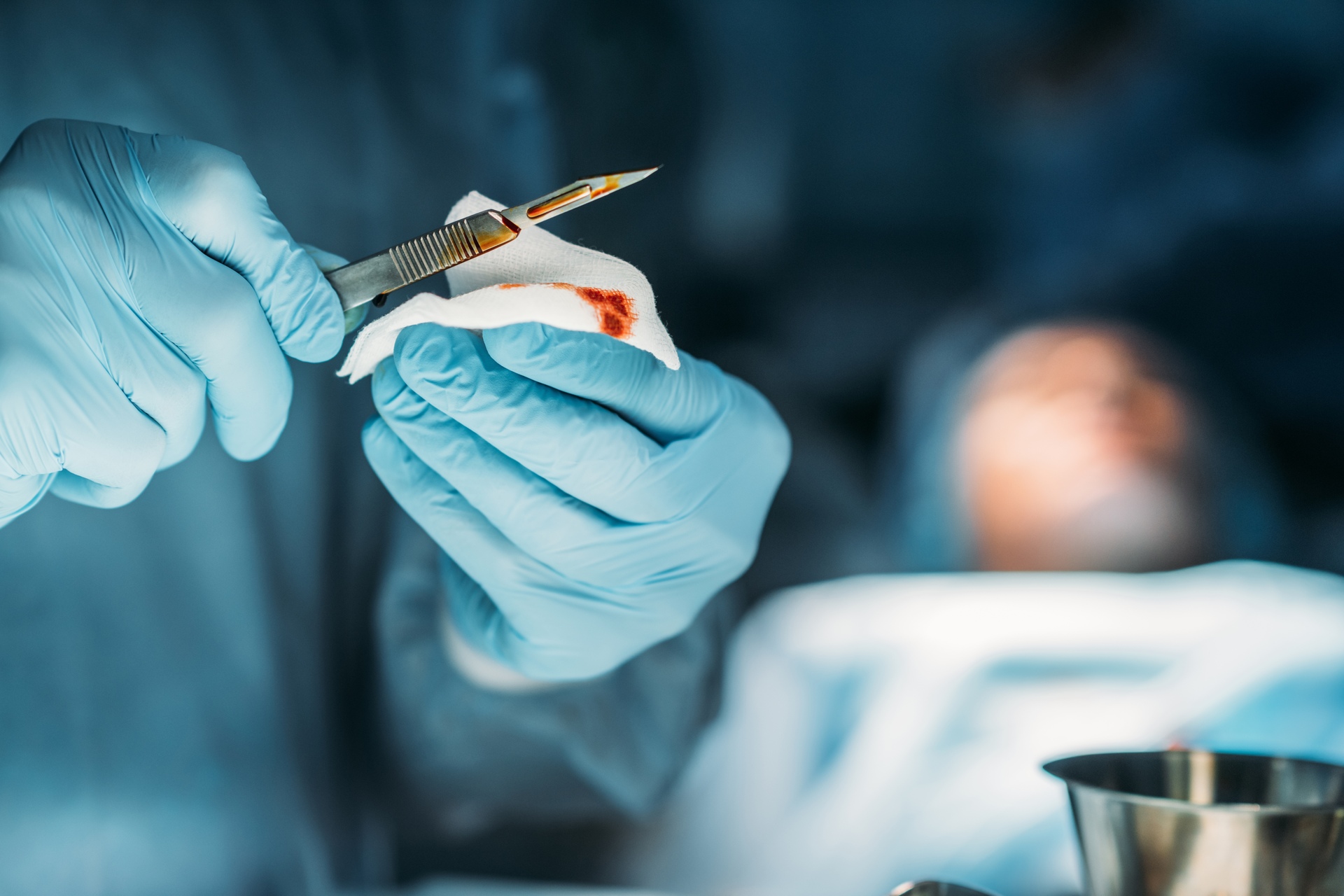 Payback: il Payback è stato una pugnalata alle spalle dell'industria e dell'innovazione bionedicale