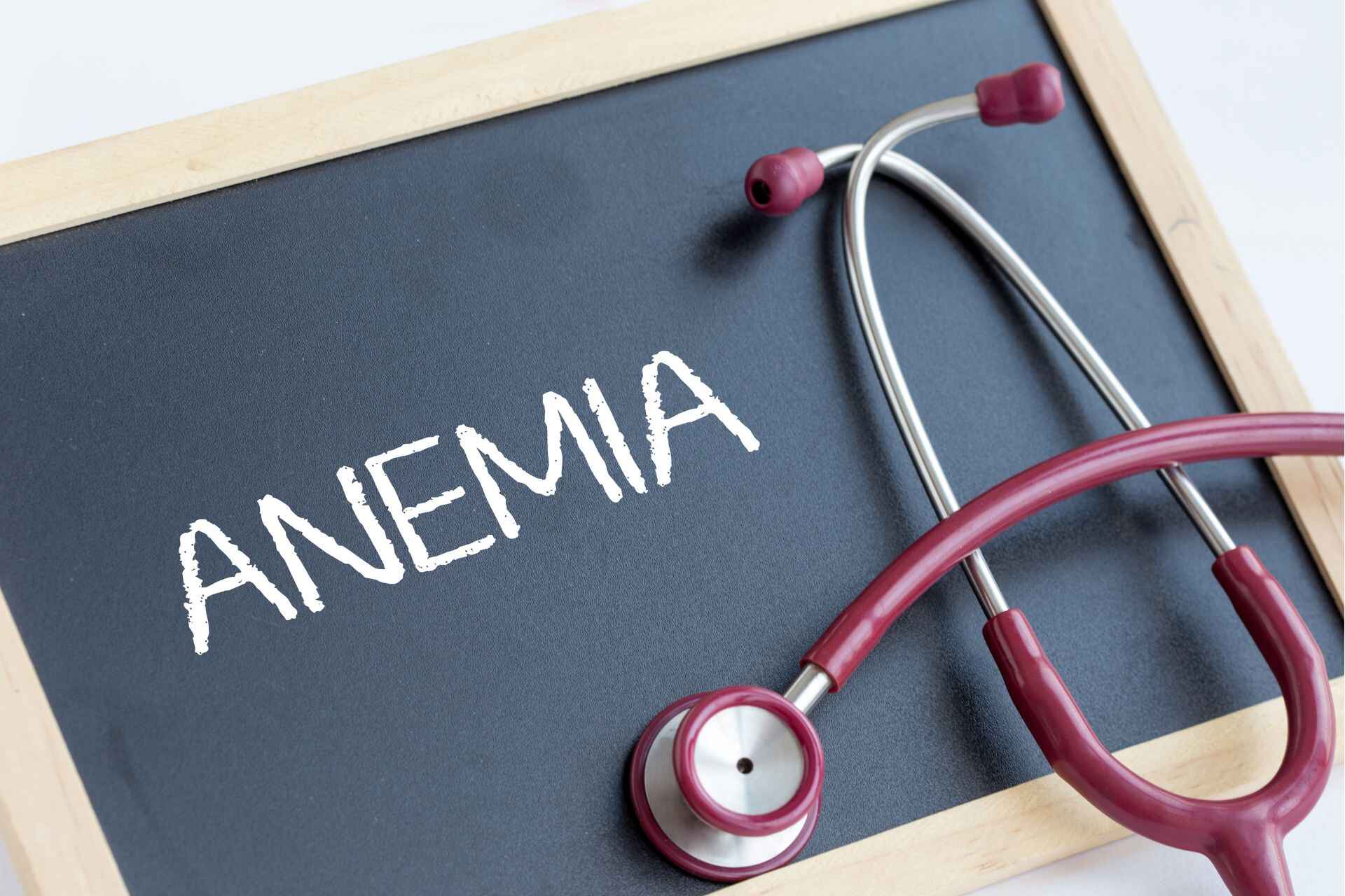 Ferro: la carenza di ferro ha come prima conseguenza l'anemia
