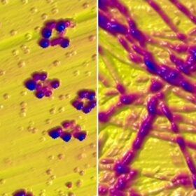 C’è l’esposizione al rame alla base del Morbo di Parkinson?