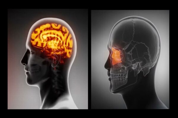 Come prevenire l’Alzheimer con il “drenaggio del cervello”