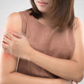 Dermatite: rimedi e prevenzione secondo un approccio innovativo