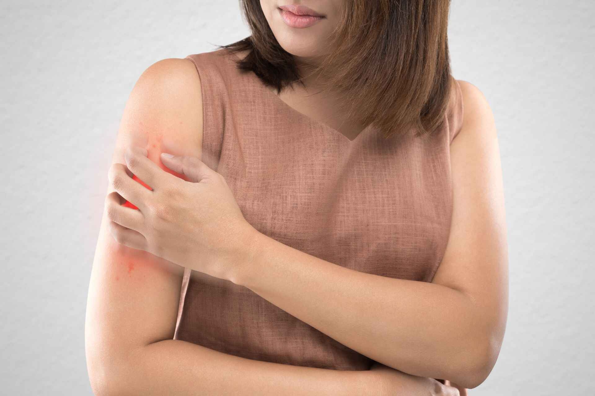 Psoriasi: cause, sintomi, cure e trattamenti in un’ottica innovativa