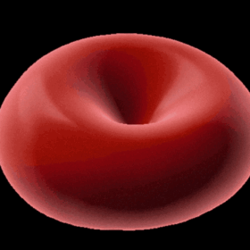 L’alterazione dei globuli rossi vista dalla microscopia olotomografica