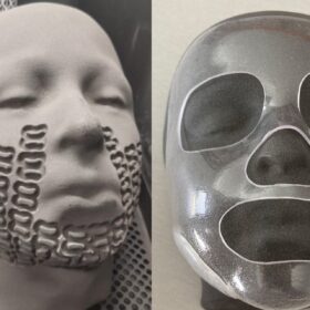 Così la stampa 3D curerà i bambini con gravi ustioni al viso