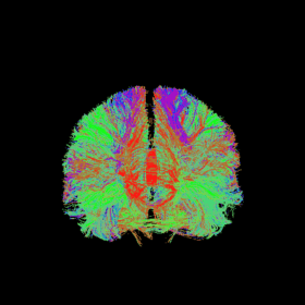 Nel cervello umano più “traffico” parallelo che in quello animale