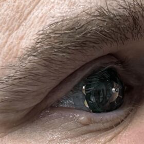 Lenti a contatto “intelligenti” per esplorare un mondo nuovo