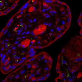 Ecco perché la placenta umana è un… bersaglio del COVID-19