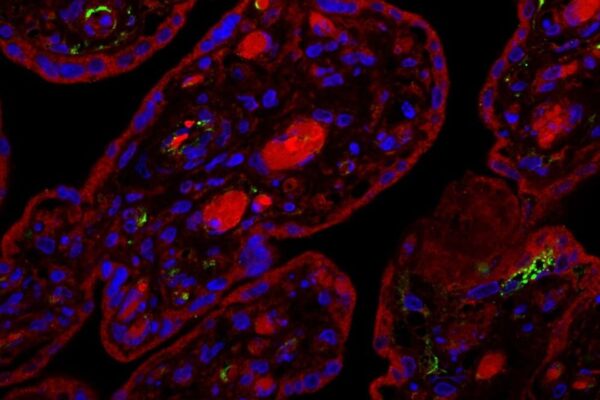 Ecco perché la placenta umana è un… bersaglio del COVID-19