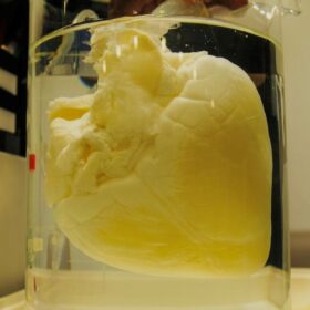 L’innovazione chiave del distretto biomedicale di Mirandola