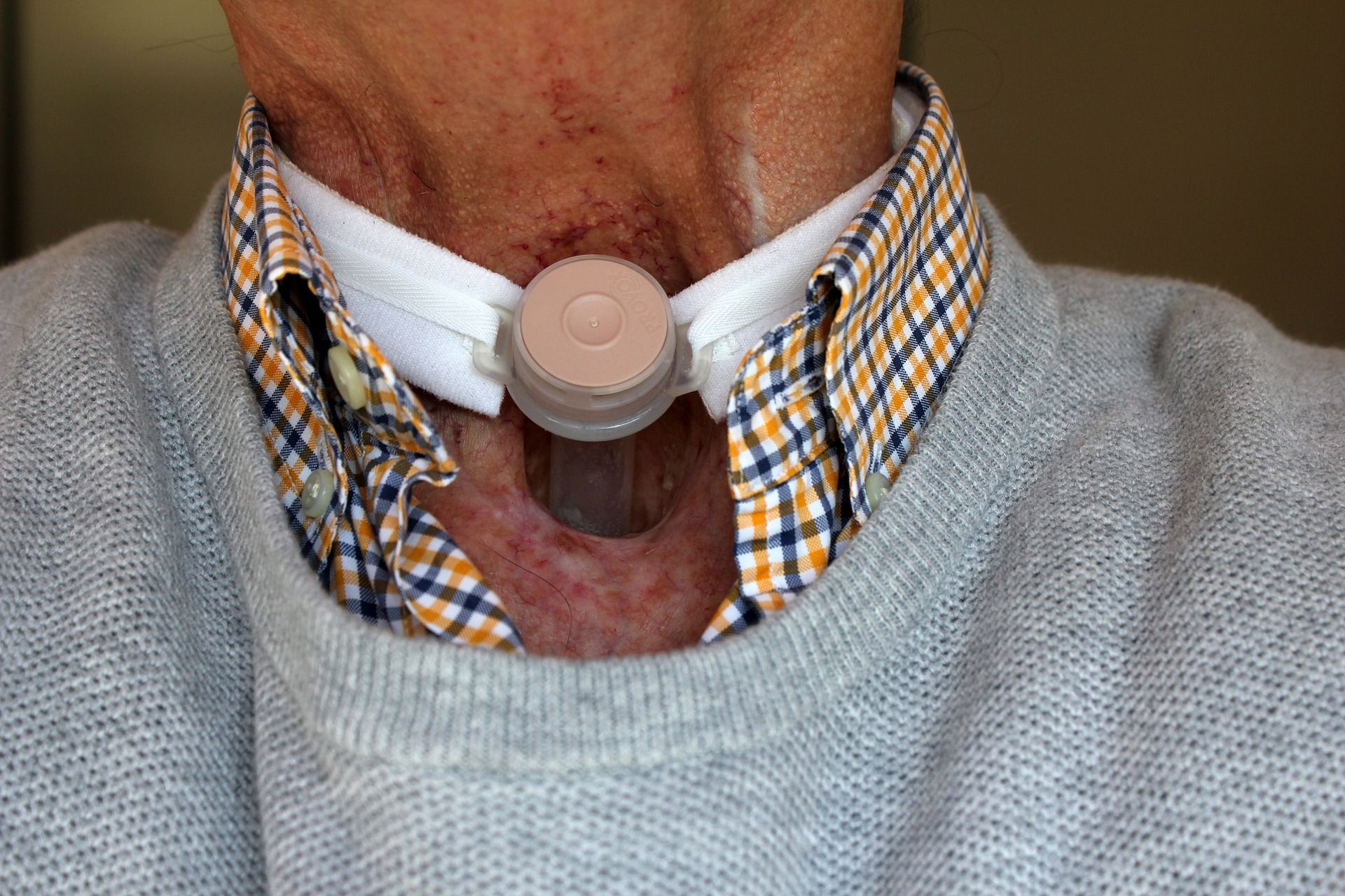 Dal PSI un inedito efficace trattamento combinato del cancro