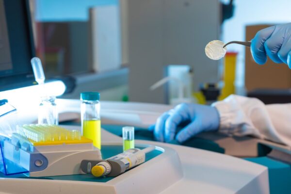 Dall’IIT una benda “smart” e vegetale per guarire le ustioni