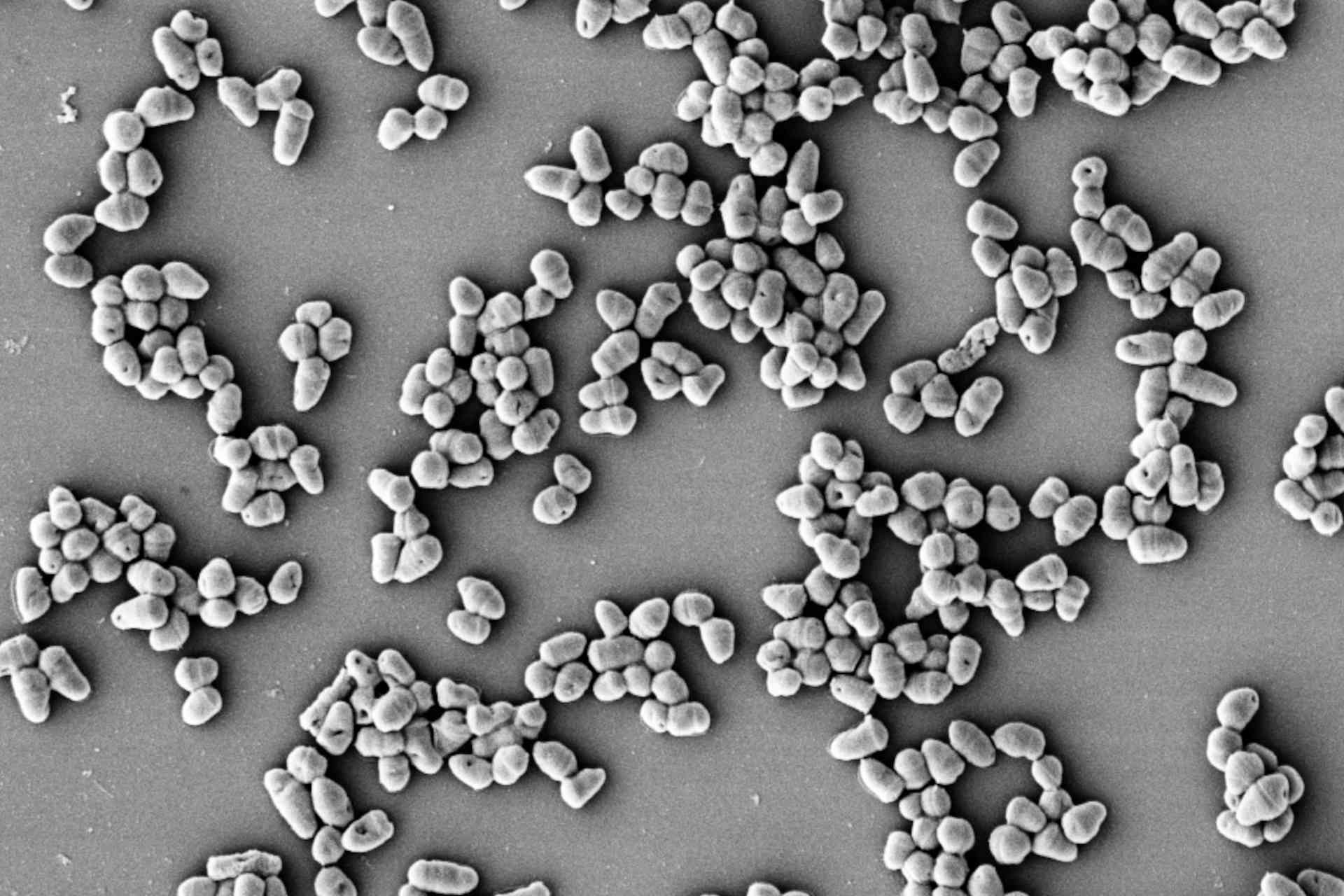 Produrre plastica biodegradabile a partire da un batterio