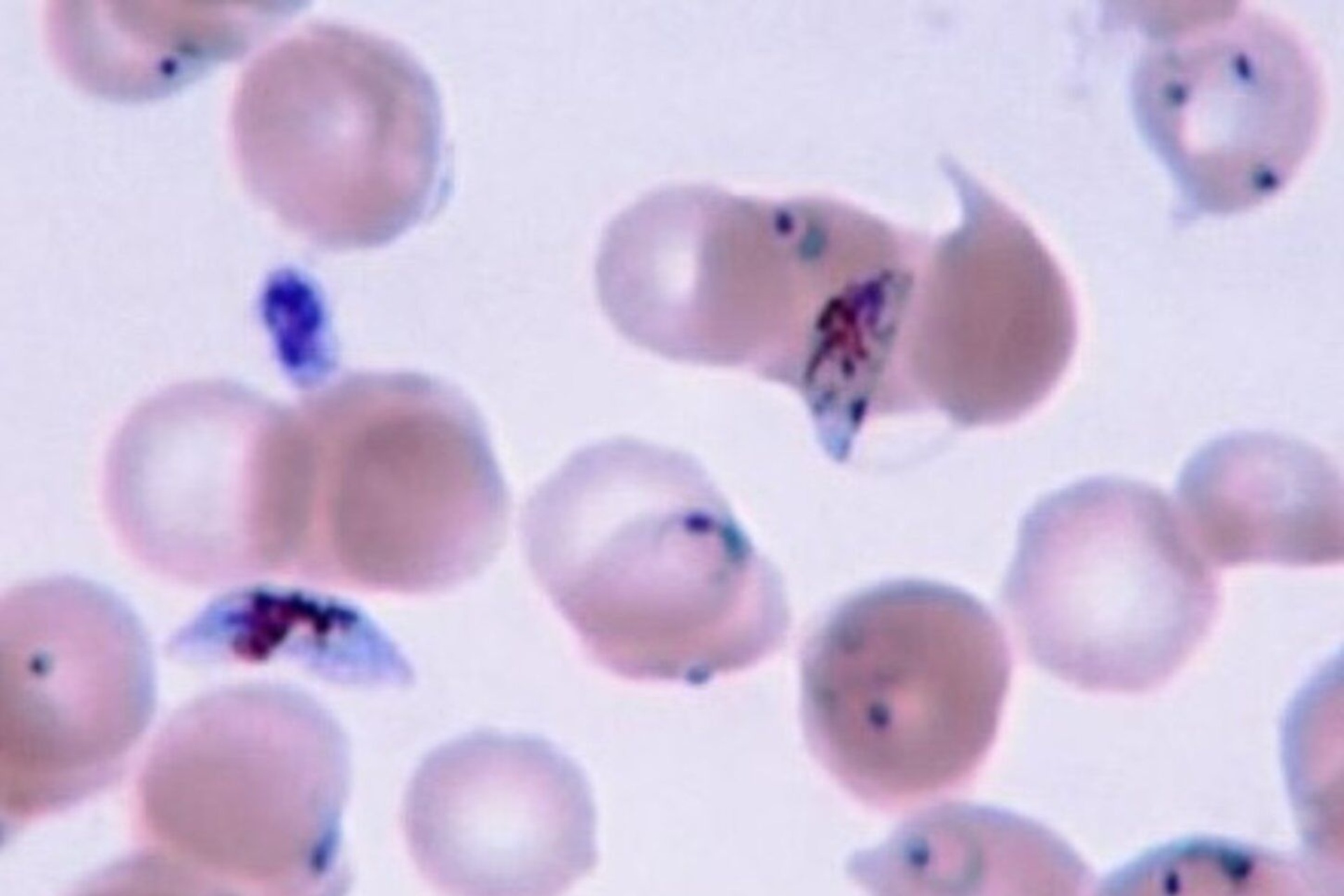 Malaria: studio dei meccanismi di infezione di Plasmodium falciparum e ruolo degli anticorpi neutralizzanti analizzati con modelli computazionali, biologia strutturale e infrastrutture di calcolo ad alte prestazioni