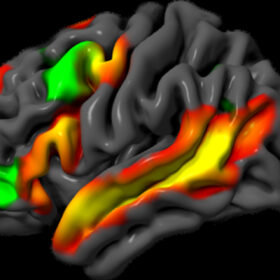 Il cervello separa logica e linguaggio: la prova arriva dal MIT