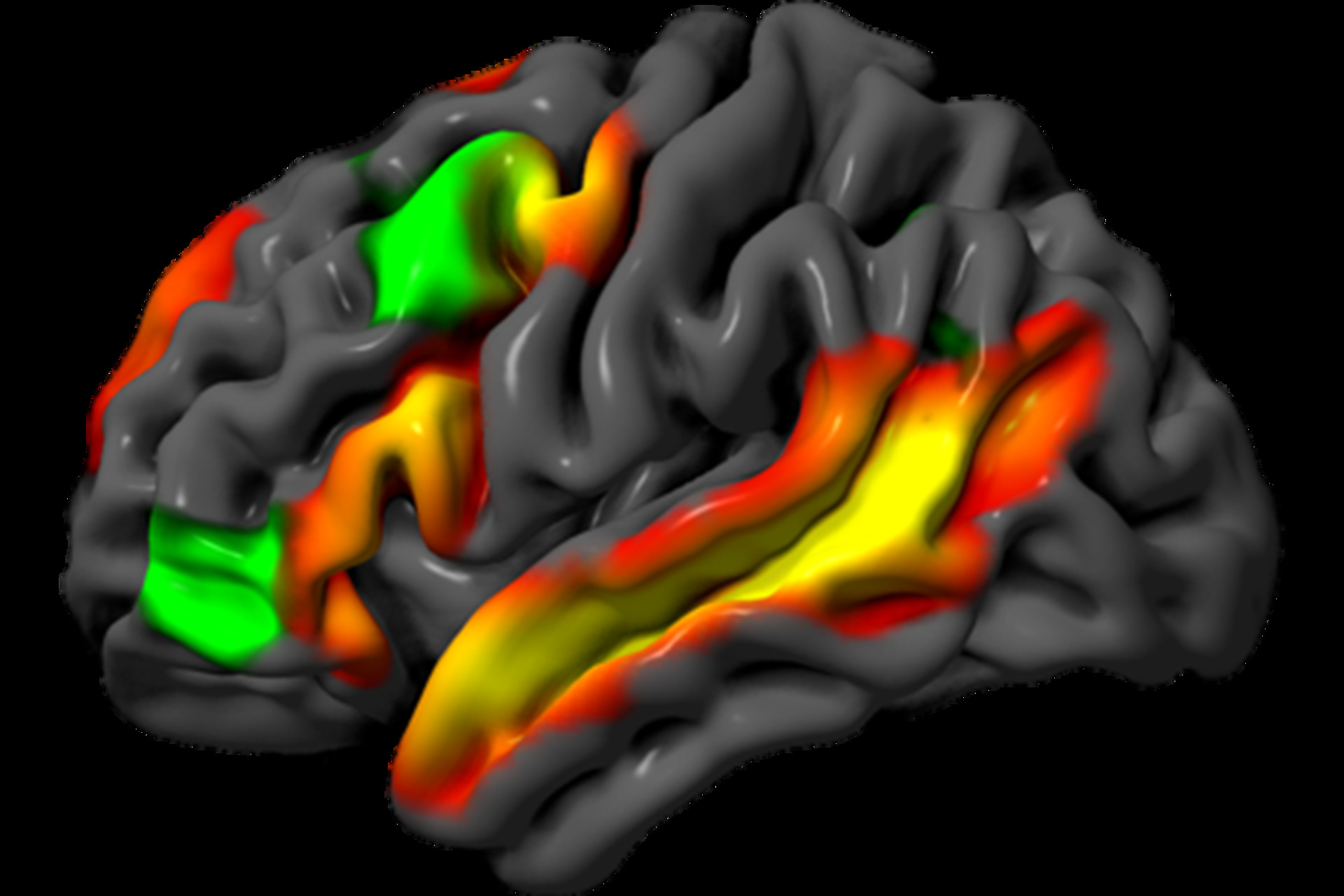 Logica e linguaggio: rappresentazione generica delle aree cerebrali coinvolte nella comprensione delle parole, nel ragionamento e nelle funzioni cognitive analizzate attraverso tecniche di neuroimaging
